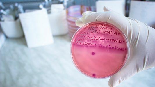 什么是抗菌添加剂？