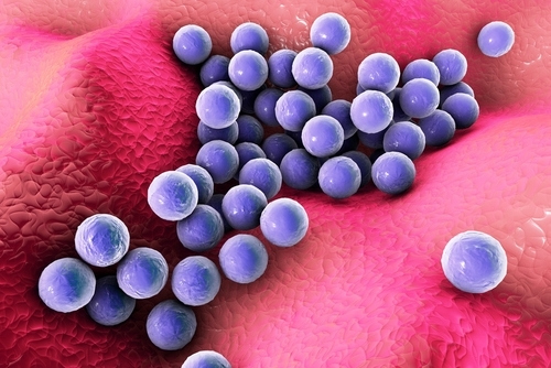 妙抗保抗菌技术可抑制引起脓肿、肺炎等症状的金黄色葡萄球菌。